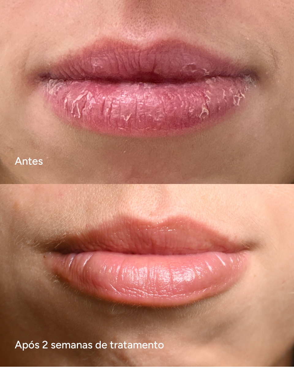 Lip Oil Regenerador Coral -