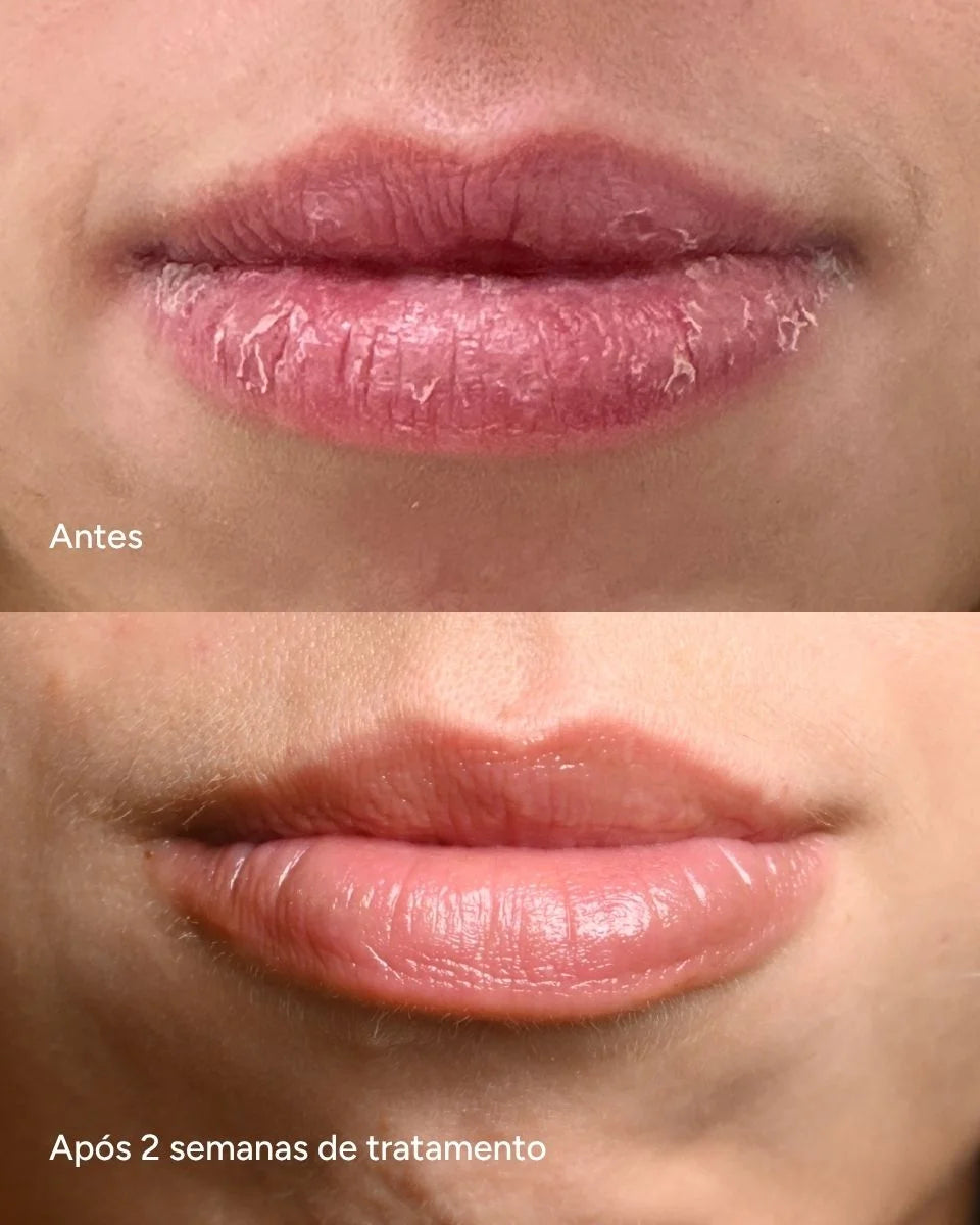 Lip Oil Regenerador - 5% Pantenol