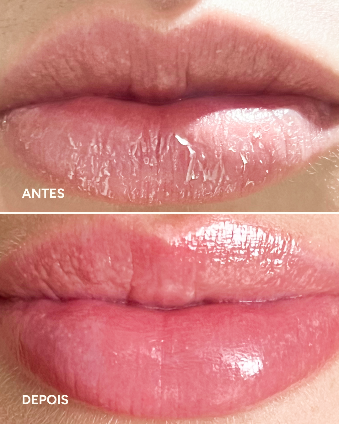 Lip Oil Regenerador - 5% Pantenol