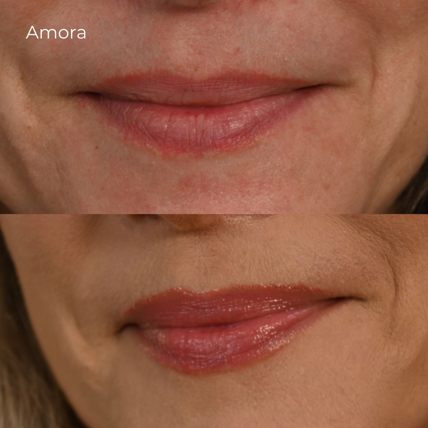 Lip Oil Multirreparador Amora - VIP